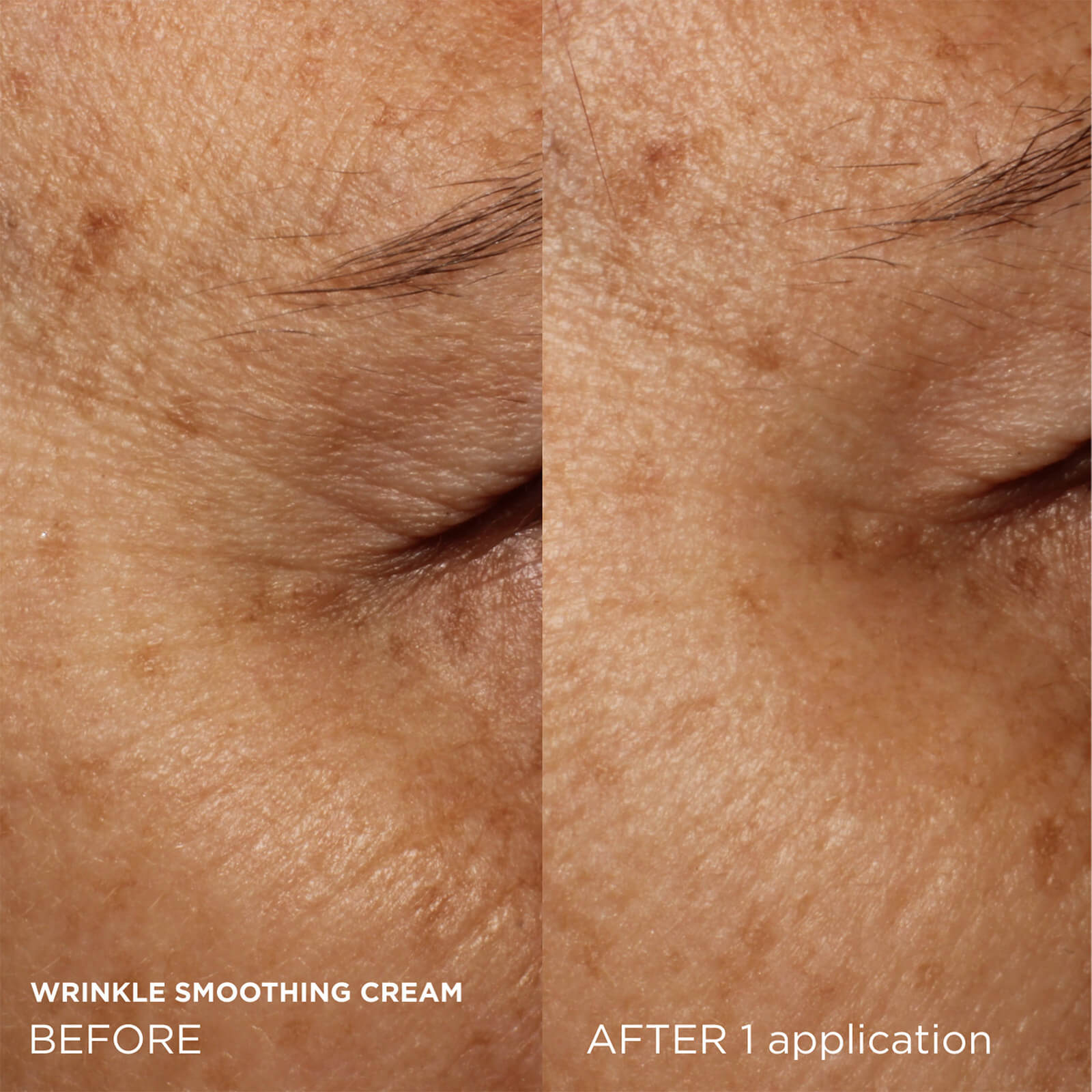 Wrinkle smoothing cream, before. after 1 application