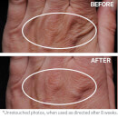 StriVectin SD™ Hand Cream (60ml/2oz)