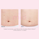 Mama Mio Goodbye Stretch Marks Stretch Mark Minimiser (100ml)