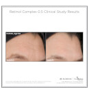 SkinMedica Retinol Complex 0.5 (1oz)
