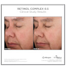 SkinMedica Retinol Complex 0.5 (1oz)