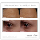 SkinMedica TNS Essential Serum