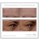 SkinMedica TNS Essential Serum