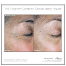 SkinMedica TNS Recovery Complex