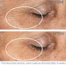StriVectin Intensive Eye Concentrate for Wrinkles