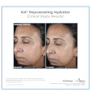SkinMedica HA5 Rejuvenating Hydrator