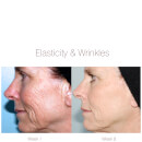 PMD Personal Microderm Tool Kit