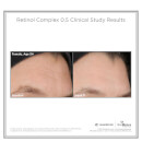 SkinMedica LYTERA 2.0 Pigment Correcting Serum and Retinol Complex 0.5 (Worth $231)
