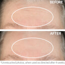 StriVectin SD Advanced™ Intensive Concentrate for Wrinkles and Stretch Marks (135ml)