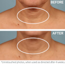 StriVectin TL Advanced Tightening Neck Cream Plus 3.4oz