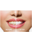 Rio Smile White Advanced Teeth Whitening Kit