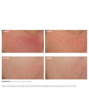 SkinCeuticals Glycolic 10 Renew Overnight