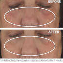 StriVectin Skin Reset 4-Week Intensive Rejuvenation System 1.2oz