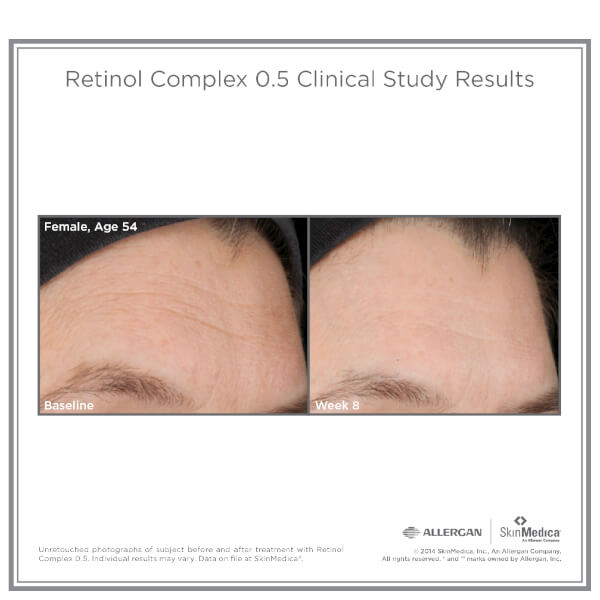 SkinMedica Retinol Complex 0.5 (1oz): Image 31