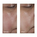 No Rinse Intensive Pore Minimizing Toner Perricone Md
