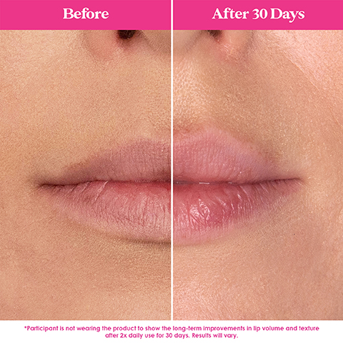 Before After 30 Days *Participant is not wearing the product to show the long-term improvements in lip volume and texture after 2x daily use for 30 days. Results will vary.