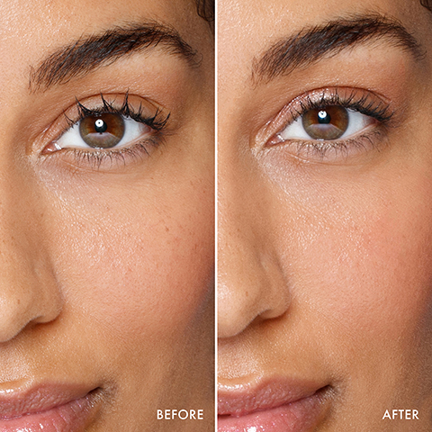 Image 1 - A close-up image shows a womans face divided into two halves, with the left labeled as BEFORE showing uneven skin tone and texture, and the right labeled as AFTER displaying smoother, more even skin.