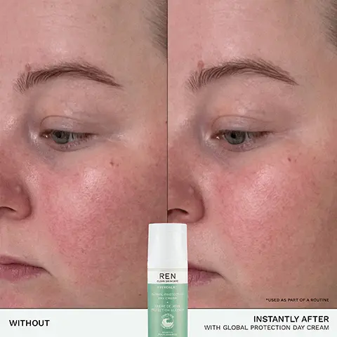 Image 1, REN EVERAL WITHOUT MOTECTION CLORE *USED AS PART OF A ROUTINE INSTANTLY AFTER WITH GLOBAL PROTECTION DAY CREAM Image 2, REN EVERCALY GLOBAL PROTES DAY CREA CREME DE ROTECTION GLO meulia 97% SAID SKIN FELT CALMER AND PROTECTED ALL DAY* USER TRIAL ON 76 VOLUNTEERS Image 3, CALMS ✓ SOOTHES ✓ HYDRATES SHIELDS SAFE FOR SENSITIVE & EZCZEMA-PRONE SKIN FAMILY SAFE Image 4, BIOACTIVES → CAMELLIA & CALENDULA OILS calm skin and replenish the skin barrier → BLACKCURRANT > SEA SEED OIL locks in moisture BUCKTHORN OIL defends against dryness Image 5, INFINITY RECYCLED PLASTIC REN CLEAN SKINCARE EVERCALMTM GLOBAL PROTECTION DAY CREAM CRÈME DE JOUR PROTECTION GLOBALE PEAUX SENSE 50 me 17 fl oz US