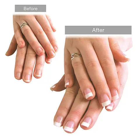 Image 1- Before and After shot. Image 2- 100 nail extensions. Image 3- Product dimensions. Image 4 - UV Nails extensions benefits