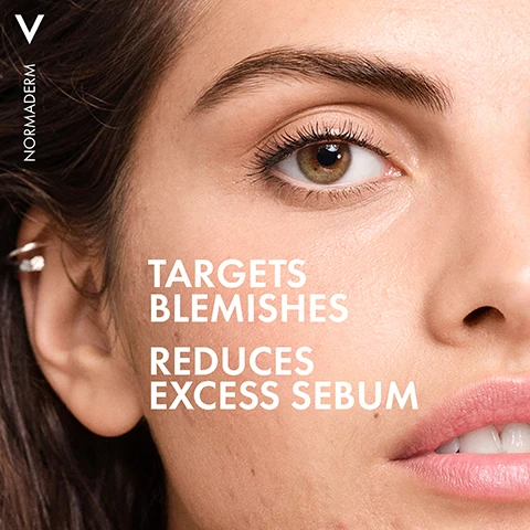 Image 1 - Close-up of a womans face with clear skin and brown eyes, showcasing visible text that reads TARGETS BLEMISHES and REDUCES EXCESS SEBUM, along with the logo NORMADERM.
              Image 2 - A close-up image of a person applying a skincare product to their cheek, highlighting their textured skin and freckles, with visible text that reads LIGHTWEIGHT NON-GREASY NON-STICKY.
              Image 3 - A person in a lab coat holds a green tube of Vichy Normaderm skincare product, displaying the labels FRAGRANCE-FREE, NON-COMEDOGENIC, and HYPOALLERGENIC.
              Image 4 - Image shows three sections with different liquid textures: the left features a clear liquid with bubbles labeled 0.5% SALICYLIC ACID [BHA], the center displays a gel-like substance with a label for ZINC GLUCONATE [Zn], and the right shows a smooth, creamy texture tagged PROBIOTIC FRACTIONS [BIFIDUS].
