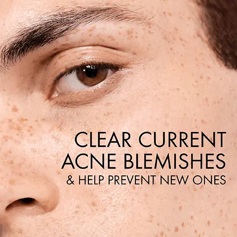Image 1, Clear current acne blemishes and help prevent new ones. Image 2, After first wash: excess shine appears reduced. After 1 week: skin looks clearer and after 4 weeks visibly reduced acne blemishes pores and blackheads. Image 3, New look same formula