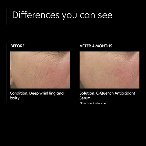 Image 1: Differences you see before and after 4 months model shot. Image 2: 5 star customer rating: i cannot say just how much i love this vit c! it has already changed my skin