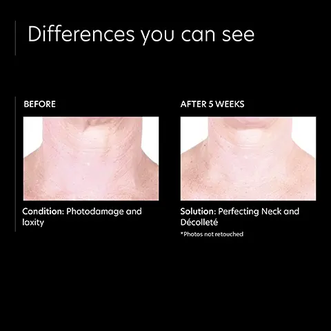 Image 1: Differences you can see before and after 5 weeks mode shot. Image 2: 5 star rating from a verified customer: I have noticed a difference with the skin on my neck since the beginning. I am true believer in this product, will never go without it, morning and night