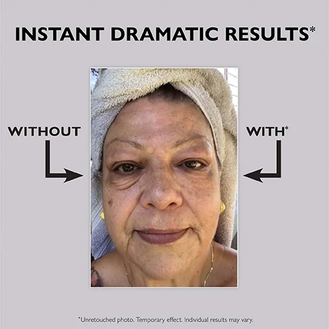 Image 1 - A close-up photo of a womans face split into Without and With sections, showing a before and after comparison, with text INSTANT DRAMATIC RESULTS* WITHOUT WITH* *Unretouched photo. Temporary effect. Individual results may vary. Image 2 - A before and after image comparison shows a persons eye area, with the before image displaying under-eye bags, wrinkles, and crows feet, and the instantly after image appearing tighter, firmer, and smoother, with text labels BEFORE, INSTANTLY AFTER*, under-eye bags, wrinkles, crows feet, tighter, firmer, smoother, and disclaimer text *Unretouched photos. Temporary effect. Individual results may vary. Image 3 - A black tube of Peter Thomas Roth Instant Firm Eye X Temporary Eye Tightener is shown with text reading FIRM-A-TITE provides instant temporary firming EYELISS helps with puffiness and wrinkles over time EYE REGENER helps with under-eye bags over time. Image 4 - A black tube of Peter Thomas Roth Instant Firm Eye Temporary Eye Tightener is shown next to a dollop of the cream with text that reads NO MORE UNDER-EYE BAGS WRINKLES & CROWS FEET* BY THE NUMBERS 100% showed improvement in the look of under-eye puffiness after just 3 minutes† 3 extra-strength skin-tightening silicates and seaweed extract CLINICAL SKIN CARE INSTANT FIRM® EYE X TEMPORARY EYE TIGHTENER instantly tightens firms & smoothes the appearance of crows feet fine lines & deep wrinkles around the eye area diminishes the look of under-eye puffiness for all skin types 30 ml / 1 fl oz *Temporary effect. Individual results may vary. †Based on a clinically measured study on 25 women ranging in age from 36 to 65. Image 5 - A hand shows a small drop of product on a fingertip with text reading Apply a tiny amount (the size of a grain of rice!) under each eye* Gently spread using upward strokes *Use the recommended amount of product to reduce the possibility of white residue. Image 6 - A black tube of Peter Thomas Roth Instant FirmX Eye Temporary Eye Tightener is shown with application instructions titled HOW TO USE FOR BEST RESULTS STEP 1 Cleanse and exfoliate skin Do not use eye cream STEP 2 Shake tube Dispense a grain-of-rice amount on top of the hand STEP 3 Pick up product with your finger or brush Apply a thin layer to completely dry skin STEP 4 Wait 3 to 7 minutes for product to dry and stay expressionless STEP 5 Gently pat away any residue using a wet cotton swab. Image 7 - A grid of eye close-ups showing before and instantly after comparisons with text that reads BEFORE, INSTANTLY AFTER*, FIRM, TIGHTEN, SMOOTH, and *Unretouched photos. Temporary effect. Individual results may vary. Image 8 - The image displays text on a grey background with two black product tubes, reading Your FAQs... Answered! Q: Where in my routine should I apply Instant FIRMx Eye? Use after cleansing and exfoliating. Pat skin dry before applying. Q: Can I use eye cream? Youll see the best results without eye cream. If you do wear eye cream, allow it to fully absorb and dry before applying Instant FIRMx Eye. Q: Can I use concealer? Yes, concealer is okay! TIP: To avoid disrupting the instant tightening effects, choose an oil-based or powder formula and wait until Instant FIRMx Eye has completely dried before applying. The tubes show text including Peter Thomas Roth Instant FIRMx Eye Temporary Eye Tightener.