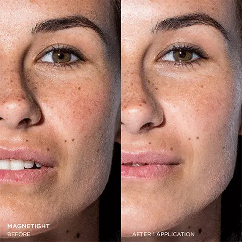 
              Before application of the magnetive vs. how the skin looks after application