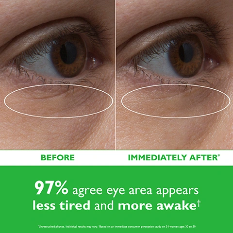Image 1 - A split image shows a close-up of an eye area, with a BEFORE section on the left displaying wrinkles under the eye, and an IMMEDIATELY AFTER section on the right showing fewer wrinkles, with text that states BEFORE, IMMEDIATELY AFTER*, 97% agree eye area appears less tired and more awake†, *Unretouched photos. Individual results may vary. †Based on an immediate consumer perception study on 31 women ages 30 to 59. Image 2 - A white Peter Thomas Roth jar with a green lid, labeled Clinical Skin Care Cucumber De-Tox® Hydra-Gel Eye Patches Timbres De Gel Hydratant Pour Les Yeux, is presented with the lid both closed and open, revealing green gel eye patches inside and some spilled onto a light green surface, alongside explanatory text: Cucumber Extract & Aloe hydrate and help soothe the look of delicate skin around the eyes, Caffeine helps awaken and de-puff the look of under-eyes, and Arnica helps brighten the appearance of dark circles. Image 3 - A split image displays a man wearing green under-eye patches, demonstrating two ways to wear them: on the left, a patch targets the outer eye area, and on the right, a patch targets the under-eye area, with accompanying text that reads CAN BE WORN TWO WAYS, soothe and target crows feet, soothe and target under-eye puffiness and wrinkles. Image 4 - A smiling woman with dark hair tied in a bun wears green under-eye patches, touching one with her right hand, against a light green background, with text that reads 100% showed immediate improvement in skin hydration in a clinical study* and *Based on an immediate clinically measured study on 31 women ages 30 to 59. Image 5 - An illustration shows two white hands, one pressing a clear plastic disc into a white jar with an arrow pointing down, while the other hand holds the jar, all against a green background, with the text Keep patches saturated & fresh! Save plastic disc and firmly press down to reseal jar after each use. Image 6 - The image displays seven Peter Thomas Roth eye patch products, a holographic packet and six open jars with various colored patches, arranged on white pedestals with the main title PICK YOUR PATCH; the products are labeled for benefits: TIGHTEN for the packet containing PETERTHOMASROTH CLINICAL SKIN CARE INSTANT FIRM COLLAGEN INFUSION TIGHTENING EYE PATCHES TIMBRES TONIFIANTS POUR LES YEUX which includes text transforms from opaque to clear when collagen infusion is complete passent dopaque à clair lorsque linfusion de collagène est terminée 1 PAIR (2 PATCHES) / 1 PAIRE (2 TIMBRES), DE-PUFF for green patches, FIRM for gold patches, SMOOTH for turquoise patches, ANTI-AGING for silver patches, BRIGHTEN for orange patches, and HYDRATE for light blue patches, with all jar bands featuring PETERTHOMASROTH.