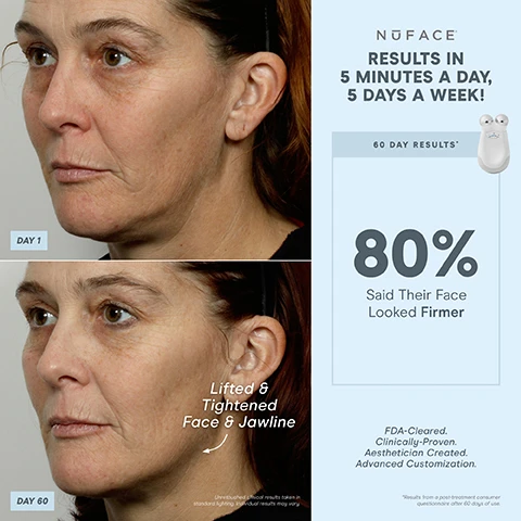Image 1, results in 5 minutes a day, 5 days a week. day 1 vs day 60. lifted and tightens face and jawline. 60 day results. 80% said their face looked firmer. unretouched clinical results taken in standard lighting. individual results may vary. FDA cleared, clinically proven, aesthetician created. advanced customization. results from a post treatment consumer questionnaire after 60 days. image 2, 1 device, 3 attachments customised treatments. wrinkles reducer attachment helps reduce full face wrinkles with a combination of red, amber and infared lights. 3 minute beep. auto shut off at 21 minutes. charging cradle. LED red light technology - perfect for customisation. FDA cleared, clinically proven, aesthetician created. image 3, help reduce lines and wrinkles - under eye, on forehead, around the mouth, around the eyes. image 4, results in 5 minutes a day, 5 days a week. day 1 vs day 60 - smoother skin. unretouched clinical results taken in standard lighting individual results may vary. 60 day results, 80% saw smoother skin. FDA cleared, clinically proven, aesthetician created, advanced customisation. results from post treatment consumer questionnaire after 60 days of use. image 5, results 5 minutes a day, 5 days a week. day one vs day 60. unretouched clinical results taken in standard lighting, individual results may vary. 60 say results, 82% said their face looked more toned. 80% said their face looked firmer. 78% saw smoother skin. FDA cleared, clinically proven, aesthetician created, advanced customisation. image 6, lift brows, contour cheeks, lift lips, contour jawlines, tighten neck. image 7, 1 device customisable results. instant results that build with consistent use contour = cheeks. lift = eyes and brows. tone = jowls and jawline. smooth = neck and forehead. lift = lips and smile lines. image 8, trinity = customised lifting. depth - to the muscle. intensity levels - 5. attachment options - eye an lip attachment and LED red light attachment sold separately - yes. micro current treatment areas - jowls and jawlines, neck, cheeks and forehead, around eyes and brows, around mouth and lips, smile lines. mini on the go-lifting = depth of treatment - to the muscle. intensity levels - 3. microcurrent treatment areas - jowls and jawline, neck and cheeks and forehead. fix instant finisher = depth of treatment - skin's surface. intensity levels - 1. microcurrent treatment areas - around eyes and brows, around mouth and lips, smile lines
