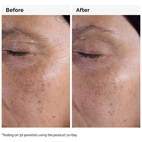 Image 1 - Side-by-side images showing a close-up of the skin around an eye labeled Before on the left and After on the right, with visible improvement in texture and reduction of dark spots; text at the bottom reads Testing on 30 panelists using the product 1x/day.
              Image 2 - Image shows a circular glass container with a light liquid inside, accompanied by text listing results: significantly smoothed skin texture, improved signs of congestion, instantly boosted skin radiance.
              Image 3 - Image of a circular glass container with a liquid inside, featuring text detailing key ingredients in Glycolic Acid 7% Exfoliating Toner, including 7% Glycolic Acid as an alpha-hydroxy acid that provides surface exfoliation and Tasmanian Pepperberry Derivative as a source of anthocyanins.
              Image 4 - A woman with smooth skin is applying a cotton pad to her face, demonstrating a skincare routine, with the text: Apply after cleansing. Sweep a saturated cotton pad across the entire face.
              Image 5 - Image shows three sections labeled PREP, TREAT, and SEAL with different skincare products displayed; PREP features cleansers and toners, TREAT includes water-based serums, eye serums, anhydrous solutions, and oils, and SEAL showcases suspensions, moisturizers, and SPF.