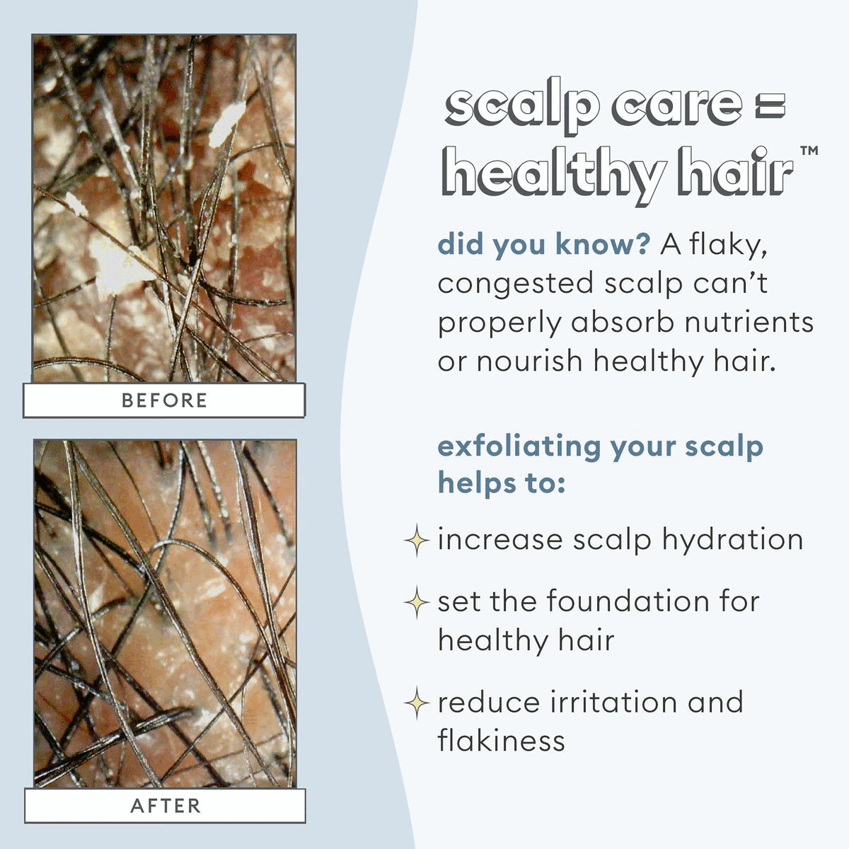 Image 1, scalp care = healthy hair. Image 2, what makes our micro-exfoliators different?. Image 3, double cleanse for your healthiest scalp.