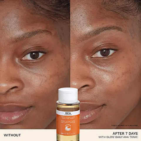 Image 1, REN 20-05US WITHOUT *USED AS PART OF A ROUTINE AFTER 7 DAYS WITH GLOW DAILY AHA TONIC Image 2, 100% SHOWED BRIGHTER SKIN* REN CLEAN SKINCARE READY STEADY GLOW DAILY AHA TONIC READY STEADY GLOW AHA LOTION TONIQUE CLEAR CE 250 mle/8.5 fl oz. US *CLINICAL STUDY ON 50 VOLUNTEERS Image 3, BIOACTIVES → LACTIC ACID helps eliminate dead skin cells → SALICYLIC ACID helps tighten the appearance of pores AZELAIC ACID PRECURSORS boost radiance and even skin tone Image 4, BRIGHTENS EVENS SMOOTHES ✓ TIGHTENS PORES HYPOALLERGENIC SUITABLE FOR SENSITIVE SKIN Image 5, REN CLEAN DENGAN READY STEADY GLOW DAILY AMA TONIC READY STEADY GLOW AHA LOTION TONIQUE 100% PCR PLASTIC BOTTLE 250 me 8.5 fl oz US Image 6, STEP 01 CLEANSE STEP 02 EXFOLIATE REN REN 25003S STEP 03 TARGET STEP 04 HYDRATE REN REN JELLY OIL READY STEADY GLOW DAILY CLEANSER AHA TONIC BRIGHTENING DARK CIRCLE EYE CREAM DARK SPOT SLEEPING CREAM