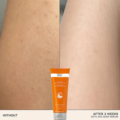Image 1, 20 WITHOUT REN AFTER 3 WEEKS WITH AHA BODY SERUM Image 2, 97% SAID SKIN FELT SMOOTHER* "USER TRIAL AFTER 7 DAYS ON 70 VOLUNTEERS Image 3, BIOACTIVES → LACTIC ACID helps eliminate dead skin cells → XYLITOL helps optimize skin's water reserves → SHEA BUTTER nourishes, softens and protects skin Image 4, SMOOTHS SOFTENS PLUMPS HYDRATES NOURISHES SUITABLE FOR SENSITIVE SKIN Image 5, 50% RECYCLED PLASTIC TUBE REN Ана билет RENEWAL BODY SERUM SERUM CORPS PERU NEUVE ÉCLAT ANA EVOLTES AND SMOOTH EXYQUE ET LISS 100% RECYCLED PLASTIC CAP 200me/68 US Image 6, STEP 01 CLEANSE STEP 02 TARGET STEP 03 HYDRATE REN ANTI-FATIGUE BODY WASH REN REN SMART-RENEWAL BODY SERUM ANTI-FATIGUE BODY CREAM