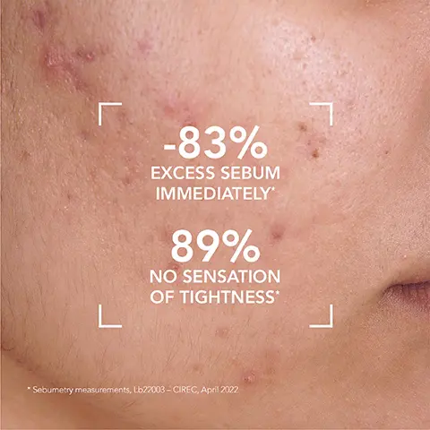 Image 1, -83% EXCESS SEBUM IMMEDIATELY* 89% NO SENSATION OF TIGHTNESS* *Sebumetry measurements, Lb22003-CIREC, April 2022 Image 2, Г L 100% PURIFIED SKIN* 7 Sebumetry measurements, Lb22003-CIREC, April 2022 Image 3, COPPER SULPHATE Purifying properties ZINC SULPHATE Purifying & seboregulating properties Image 4, OILY TO ACNE-PRONE SKIN 123 Cleanse Care Treat BIODERMA LABORATOIRE DERMATOLOGIQUE Sébium Gel moussant BIODERMA LABORATOIRE DERMATOLOGIQUE Sébium Sensitive Soin apaisant anti-imperfections Peaux à tendance acque sensibles et rapiste Soothing anti-blemish care Sensitive and weakened BIODERMA LABORATOIRE DERMATOLOGIQUE Sébium Kerato+ Gel-crème anti-imperfections haute tolérance Image 5, 1 2 Apply Sébium Foaming Gel daily on wet skin Work into a foam Rinse and gently dry