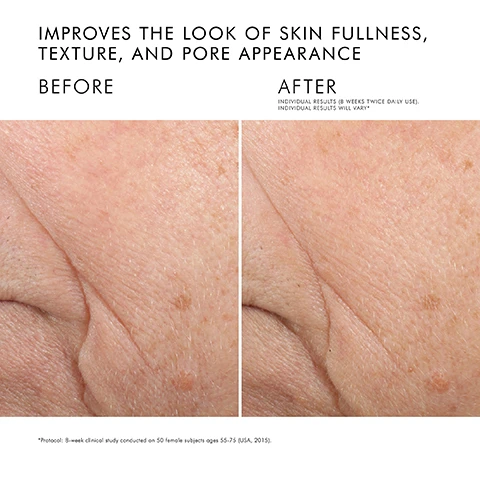 Image 1 - Side-by-side images of skin showing improvement in fullness and texture, with the left labeled BEFORE and the right labeled AFTER, including the text IMPROVES THE LOOK OF SKIN FULLNESS, TEXTURE, AND PORE APPEARANCE at the top, and INDIVIDUAL RESULTS (8 WEEKS TWICE DAILY USE). INDIVIDUAL RESULTS WILL VARY* at the bottom.
              Image 2 - Image shows a clear glass bowl containing a creamy substance, with annotations listing key ingredients: 2% Pure Ceramides 1 & 3 with a description about moisture retention, 4% Natural Cholesterol noted for skin hydration, 2% Fatty Acids aiding skin elasticity, and an Essential Oil Blend of lavender, rosemary, and peppermint for a nourishing feeling.
              Image 3 - A close-up image of a creamy white skincare product with descriptions outlining its benefits, stating it improves skin fullness, restores essential skin lipids, and promotes radiance and firmness, along with a product label that reads SkinCeuticals TRIPLE LIPID RESTORE 2:4:2 ANTI-AGING LIPID REPLENISHMENT TREATMENT 2% CERAMIDES | 4% CHOLESTEROL | 2% FATTY ACIDS.
              Image 4 - A close-up of a person applying a cream to their cheek, with the text Restores + protects skins barrier displayed next to the cream.
              Image 5 - A close-up of a thick, creamy emollient with visible text indicating the texture as Emollient cream and skin types listed as Normal, Dry, Combination, Sensitive.
              Image 6 - Image shows a skincare morning regimen with four products: a brown bottle labeled C E Ferulic, a purple bottle labeled H. A. Intensifier Multi-Glycan, a white jar labeled Triple Lipid Restore 2:4:2, and a tube labeled Ultra Facial Defense Sunscreen SPF 50, with headings indicating steps for prevention and correction.
              Image 7 - Image shows a skincare regimen laid out in four steps with corresponding product images; step 1 is Prevent with the product Resveratrol B E, step 2 is Correct with Retinol 0.3, step 3 is Correct with Triple Lipid Restore 2:4:2, and step 4 is Correct with A.G.E. Advanced Eye.