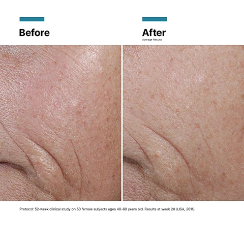 Image 1 - Image showing a side-by-side comparison of skin before and after treatment, with the left side labeled Before displaying visible wrinkles and the right side labeled After showing smoother skin, along with text at the bottom detailing a 52-week clinical study on 50 female subjects ages 40-60 years old, with results at week 20.
              Image 2 - Image of a dropper filled with yellow liquid next to a petri dish containing drops of the same liquid, accompanied by text highlighting key ingredients: 15% PURE VITAMIN C (L-ascorbic acid), 1% VITAMIN E (Alpha tocopherol), and 0.5% FERULIC ACID.
              Image 3 - Image shows a dropper bottle of SkinCeuticals C E Ferulic serum with glossy liquid drops and visible text stating PROVEN RESULTS, Increases firmness, Reduction in the appearance of fine lines, and Reduction in the appearance of wrinkles.
              Image 4 - Image of a fast-absorbing serum depicted in a fluid, glossy texture, accompanied by text stating Texture Fast-absorbing serum Skin Type Normal Dry Combination.
              Image 5 - A professional woman with long, dark hair is smiling and wearing a black blazer, alongside a text box that includes the title PHYSICIAN INSIGHT and a quote about a products antioxidant benefits attributed to Dr. Ana Mansouri from Dr Ana The Skin Clinic.
              Image 6 - Image comparing three antioxidant serums, including C E Ferulic, Silymarin CF™, and Phloretin CF, along with their concerns, skin types, and benefits: C E Ferulic addresses wrinkles and loss of firmness for normal, dry, or combination skin with anti-aging benefits; Silymarin CF™ targets blemishes and oily skin for combination and oily types with oil and blemish control benefits; Phloretin CF focuses on fine lines, discoloration, and uneven skin tone for normal, combination, or oily skin, promoting an even skin tone.
              Image 7 - A close-up image shows a hand holding a dropper dispensing facial oil onto another hand, accompanied by instructions for application: Step 1 - In the morning after cleansing, dispense 4-5 drops into clean hands; Step 2 - Gently press into skin on the face, neck, and décolleté.
              Image 8 - Image showing four skincare products arranged in a row with headers for each step: Step 1 Prevent, C E Ferulic; Step 2 Correct, H.A. Intensifier Multi-Glycan; Step 3 Correct, A.G.E. Interruptor Advanced; Step 4 Protect, Advanced Brightening UV Defense Sunscreen SPF 50.
              Image 9 - Image showing a comparison chart titled A.M. / P.M. Antioxidant Comparison featuring two skincare products: C E Ferulic on the left with a dropper bottle, and Resveratrol B E on the right in a pump bottle; the chart includes concerns, skin types, and benefits for both products.