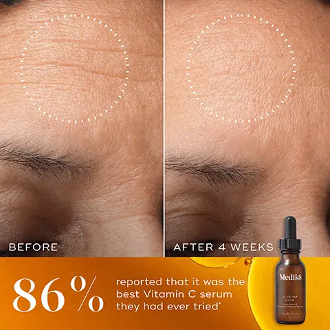 Image 1, BEFORE 86% AFTER 4 WEEKS reported that it was the best Vitamin C serum O they had ever tried' Medik8 CITETRA LUKE Image 2, C-TETRA vs. C-TETRA LUXE NEW TO VITAMIN C? Medik8 Medik8 C-TETRA LUXE 2x 2X MORE Vitamin C than C-Tetra HAVE SENSITIVE SKIN? Ultra-gentle formula for radiant-looking skin C-TETRA SUPERCHARGED RESULTS For clinical brightening & nourishing power Image 3, AM Mediks HOW TO LAYER Mediks Mediks Mediks CLEANSE TONE VITAMIN C SUNSCREEN EXPERT ADVICE: Follow with vitamin A as part of your evening routine to maintain maximum age-defying results. Image 4, THE CSA PHILOSOPHYR Medik8's clinically proven skincare approach that addresses 90% of anti-ageing skincare needs in just 3 simple steps. BRIGHTENS for glowing skin PROTECTS RENEWS for youthful skin for perfected skin Medik8 + Medik8 + Mediks VITAMIN C SUNSCREEN VITAMIN A ✡AM ✡AM PM