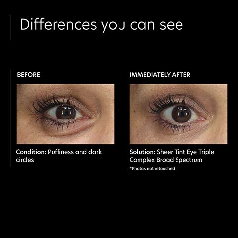Image 1, differences you can see, before and immediately after. condition before = puffiness and dark circles. solution = sheer tine eye triple complex broad spectrum *photos not retouched.