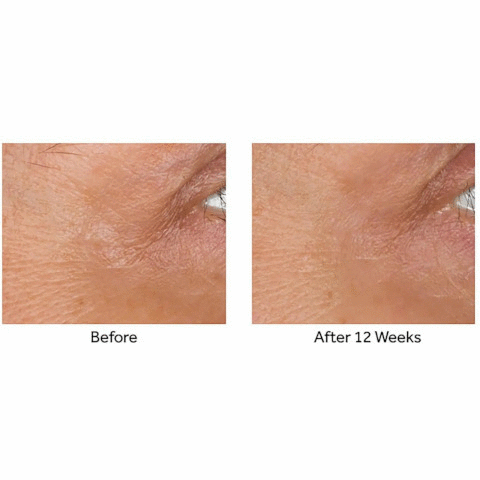  Before image showing wrinkles and lines after 12 weeks result image using reduced appearance of wrinkles and lines. Collagen peptide technology our anti-wrinkle peptide technology is clinically proven to visibly reduce the appearance of lines and wrinkles supercharge your routine 1. line correcting booster serum use before your usual no7 serum. 2. serum follow with your no7 serum. 3. eye cream then apply your no7 eye cream 4. day/night cream finish am/pm with your no7 day or night cream