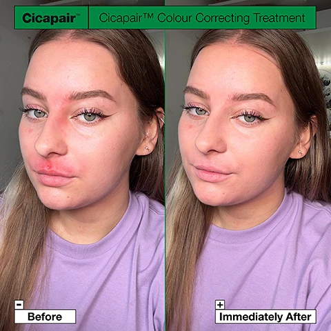Image 1 - A person with long hair is shown in two side-by-side images; the left side is labeled Before, showing redness on their cheeks, and the right side is labeled Immediately After, showing a more even skin tone after using Cicapair Colour Correcting Treatment.
              Image 2 - Image shows two Cicapair Colour Corrector products side by side on a green background. The left container is a cream with labels that say Cicapair and Medium weight, creamy texture, Neutralises the look of redness, Natural-matte finish, No SPF. The right container is a dropper bottle with the label Cicapair and text that states Lightweight, serum-like texture, Neutralises the look of redness, Dewy finish, SPF 35. The heading reads Which Cicapair Colour Corrector is right for you?
              Image 3 - A textured green cream background with visible text stating: ADAPTS TO SKINS NATURAL COLOUR, NEUTRALISES REDNESS, EVENS OUT SKIN TONE, REVIVES APPEARANCE OF FATIGUED SKIN.
              Image 4 - Image shows a green background with the text Cicapair™ Tiger Grass Colour Correcting Treatment at the top, followed by three statistics: 89% Said skin felt soothed with moisture, 88% Said skin looked less red, and 85% Said skin tone looked even, and a footnote stating *Study of 109 women between 20-50 for 1 week, December 2021.