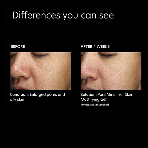 Image 1, differences you can see, before and after 4 weeks. condition before = enlarged pores and oily skin. solution = pore minimizer skin mattifying gel, *photos not retouched. Image 2, verified customer review, this product has done wonder to minimize the appearance of my pores.