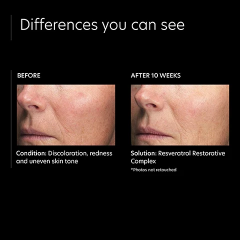 Image 1, differences you can see, before and after 10 weeks. condition before = discoloration, redness and uneven skin tone. solution = resveratrol restorative complex. *photos not retouched. Image 2, verified customer review = feels great on your skin, very calming, makes skin tone even, great product.