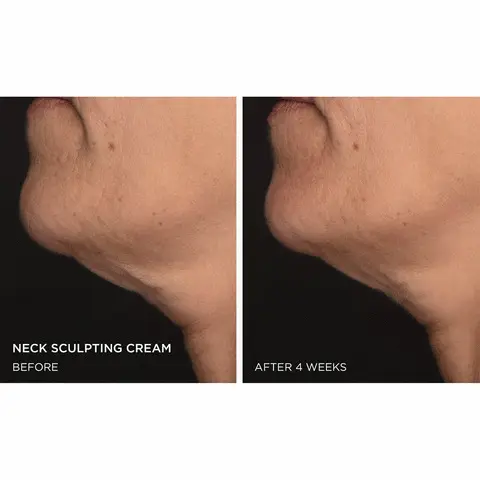 neck sculpting cream before, after 4 weeks, necks sculpting cream before, after 8 weeks