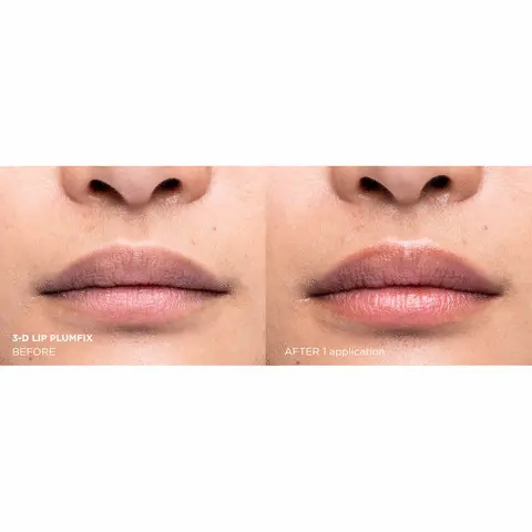 3-d lip plumfix before, after 1 application
