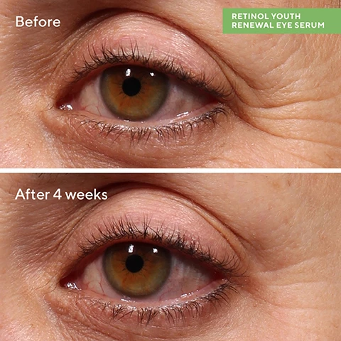 Image 1, before and after 4 weeks. retinol renewal eye serum. image 2, after 2 weeks reduces appearance of fine lines and wrinkles and puffiness around the eyes. after 4 weeks - firms skin around the eyes. image 3, retinol tri-active technology = a fast acting retinoid, a time released retinol and retinol booster help fight lines and deep wrinkles. cotton wool grass extract = delivers 24 hours of hydration to minimise dryness. marine kelp complex = mineral and antioxidant rich blend helps visibly lift for revitalised, youthful looking eyes. image 4, evening routine for brighter morning eyes. results you can see for yourself. 1 = retinol youth renewal eye masks - after cleansing, apply eye masks for 15 minutes, remove and pat in any remaining product. 2 = retinol youth renewal eye serum - follow with a thin layer of eye serum round the under eyes and lids.