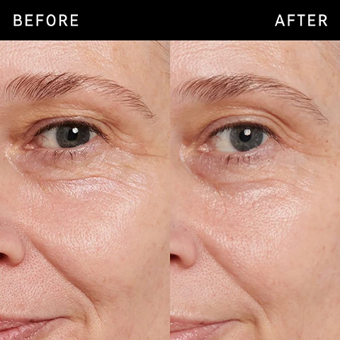 Image 1 - The image shows a close-up of a persons face comparing the skin condition before and after a treatment; the left side is labeled BEFORE and shows more wrinkles and texture, while the right side is labeled AFTER and appears smoother with a more hydrated look.
              Image 2 - A white tube of eye cream labeled RETINOL EYE CREAM is shown, with text indicating it is a night eye cream for first signs of aging, smoothing, rejuvenating, and reducing fine lines and wrinkles, and that slow-release Retinol helps avoid irritation.
              Image 3 - A close-up image of a creamy, off-white product texture with the words Ingredients and 3% VITALEASE™ (RETINOL) Targets signs of aging with minimal irritation visually displayed.
              Image 4 - A close-up image of a woman with a light cream applied to her cheek, accompanied by text that states FAQ, when should I start using retinol? 25 years old, when skin cell turnover starts to slow, how does this differ from retinol serum? this is a targeted treatment specially formulated for the delicate under-eye area. it is also suitable for use around the mouth to help minimize fine lines, use 2-3 times per week.
              Image 5 - An illustration of a creamy skincare product swatched on a white surface, with the text How to layer your routine above and numbered steps below reading 1 Clean 2 Hydrate 3 Treat 4 Moisturize 5 SPF.
              Image 6 - A person with fair skin and light hair applies a tube of retinol eye cream to their cheek while touching their finger to their lips, accompanied by the text When to apply PM and a crescent moon icon.