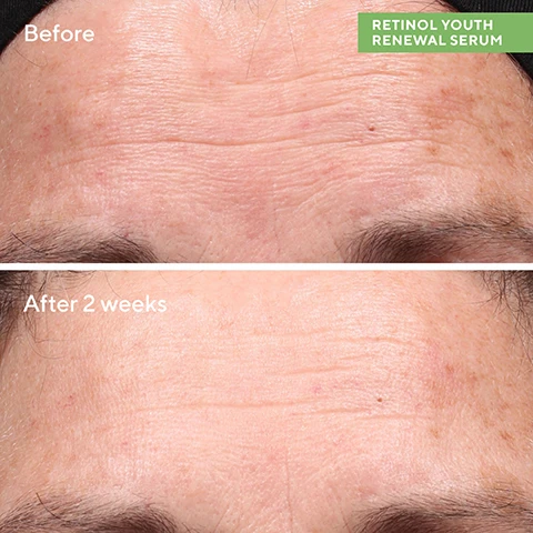 Image 1, before and after 2 weeks. image 2, after 2 weeks = clinically tested to visibly improve signs of skin ageing, visibly firms skin, 92% saw smoother skin. after 4 weeks = 99% agreed it was gentle enough for nightly use. proven results reported by 56 trial participants aged 35-65 in an 8 week clinical study. image 3, retinol tri-active technology = quickly and visibly minimises lines and deep wrinkles evens skin tone and boosts radiance. swertia flower extract = helps increase skin's resilience and improve the look of youthful contours. hyaluronic acid = hydrates to visibly plump and minimise dryness. image 4, whats your retin-type A or O? retinal, type A = corrective. retinol, type O = preventative. image 5, how to use = PM. 1 = retinol youth renewal serum - at night apply a thin layer of serum to face, reduce frequency if sensitivity occurs. 2 = retinol youth renewal eye serum - morning and night gently pat eye serum around under eyes and lids, warming - avoid contact with eyes. retinol youth renewal night cream - at night massage cream evenly over face, neck and chest. always apply SPF in the morning.