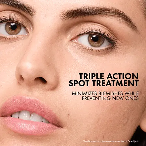 Image 1, Triple action spot treatment minimizes blemishes while preventing new ones. Image 2, Sulfur acne treatment to dry up acne blemishes and fragrance free. Image 3, Dermatologist recommended ingredients: 10% sulfur helps control acne blemishes, niacinamide reduce moisture loss and Glycolic acid and helps revea smoother skin. Image 4, minimizes blemishes while preventing new ones without drying the skin. Image 5, Apply a thin layer directly on acne blemish at night and blend into skin